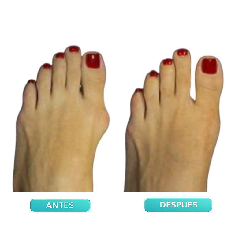 Corrector de Juante